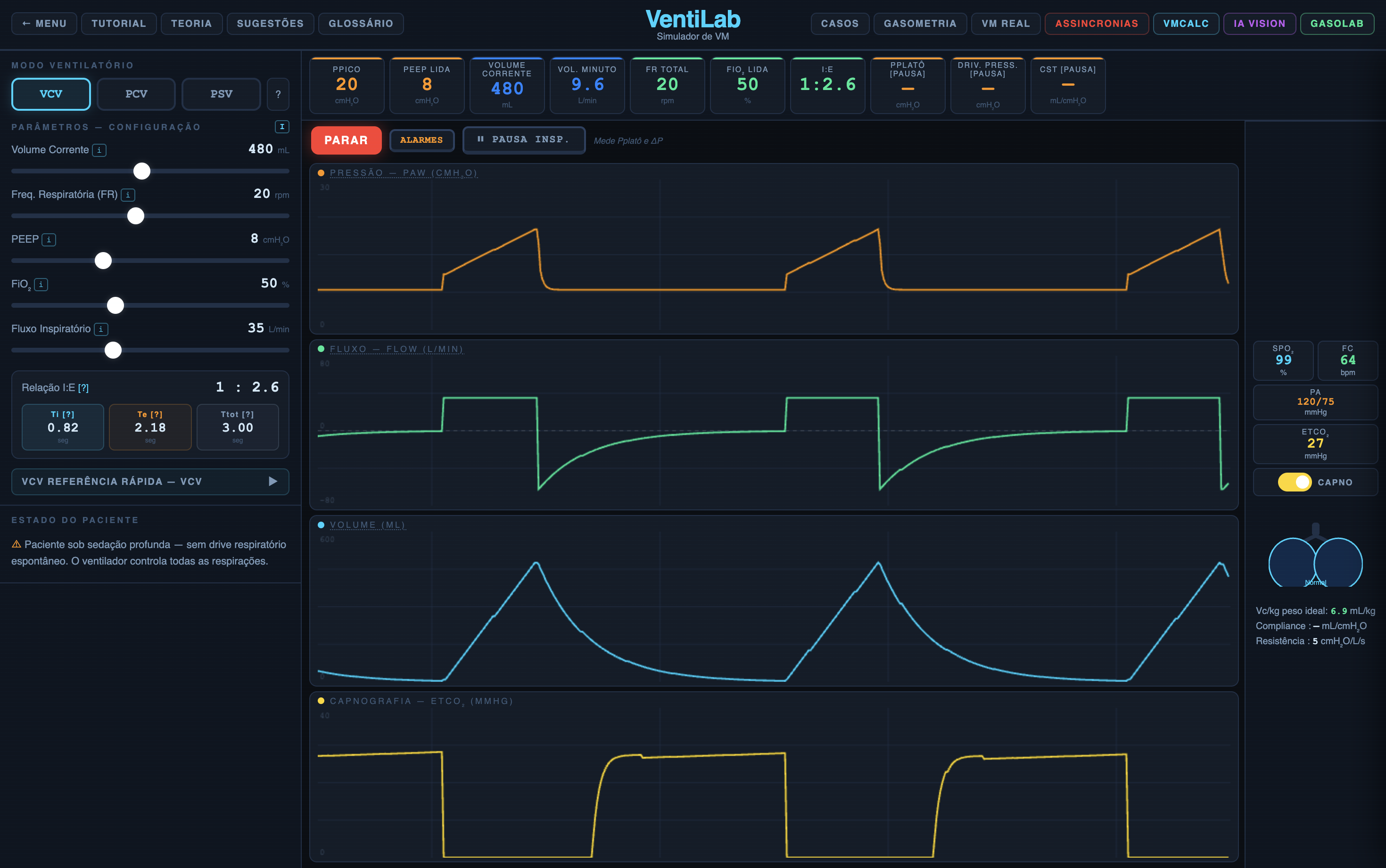 VentiLab desktop