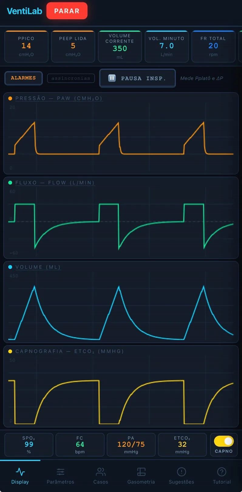 VentiLab curvas e waveforms